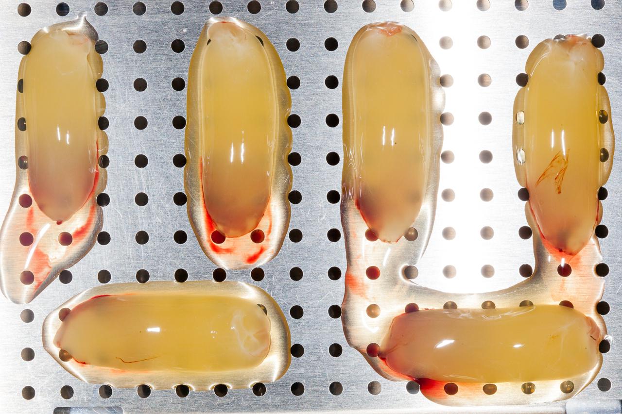 Foto Three-Dimensional Architecture and Cell Composition of a Chokroun’s Platelet-Rich Fibrin Clot and Membrane